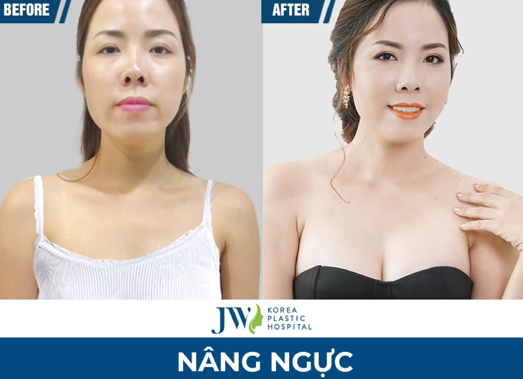 nang nguc golden line1
