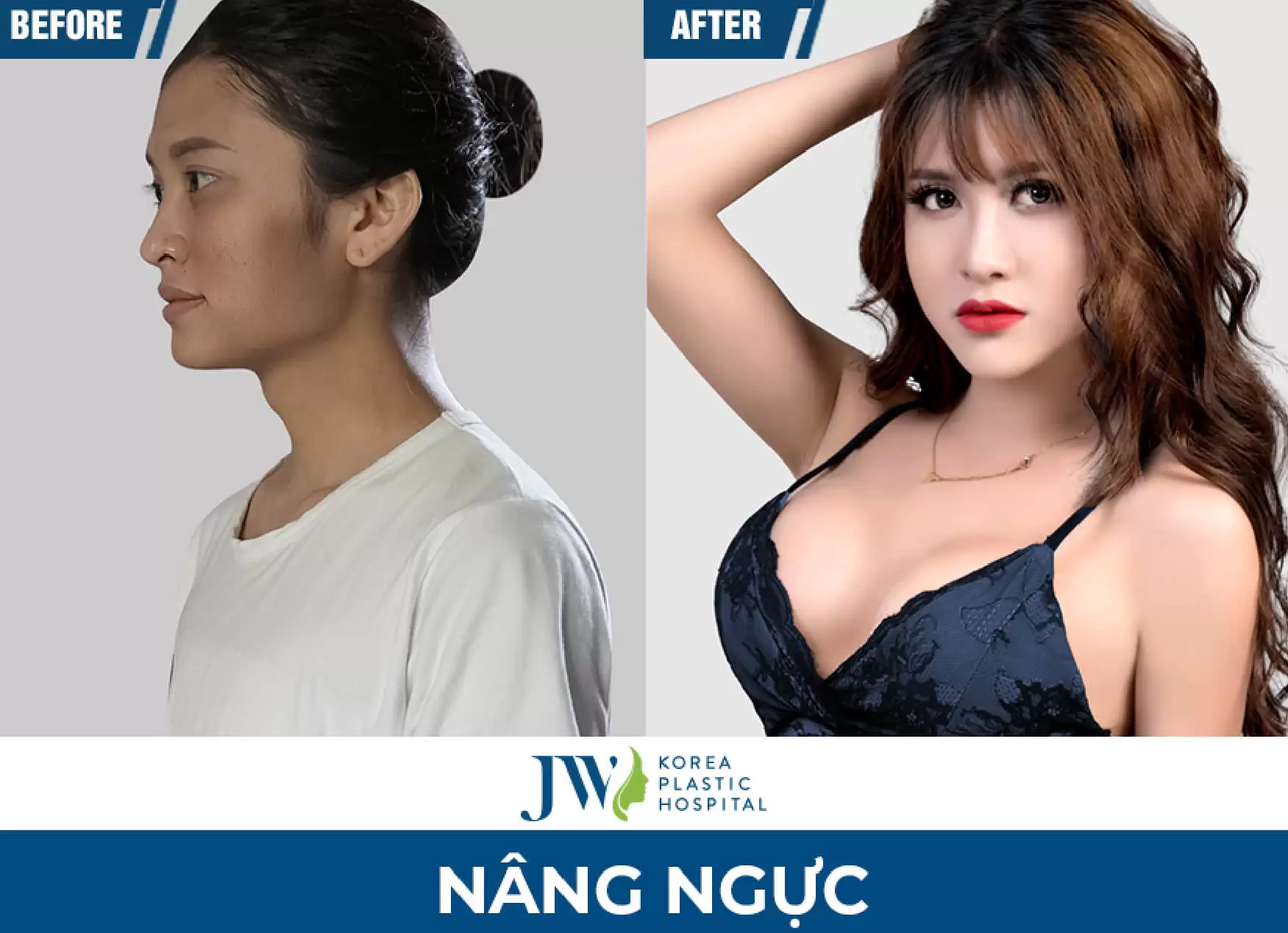 nang nguc golden line2