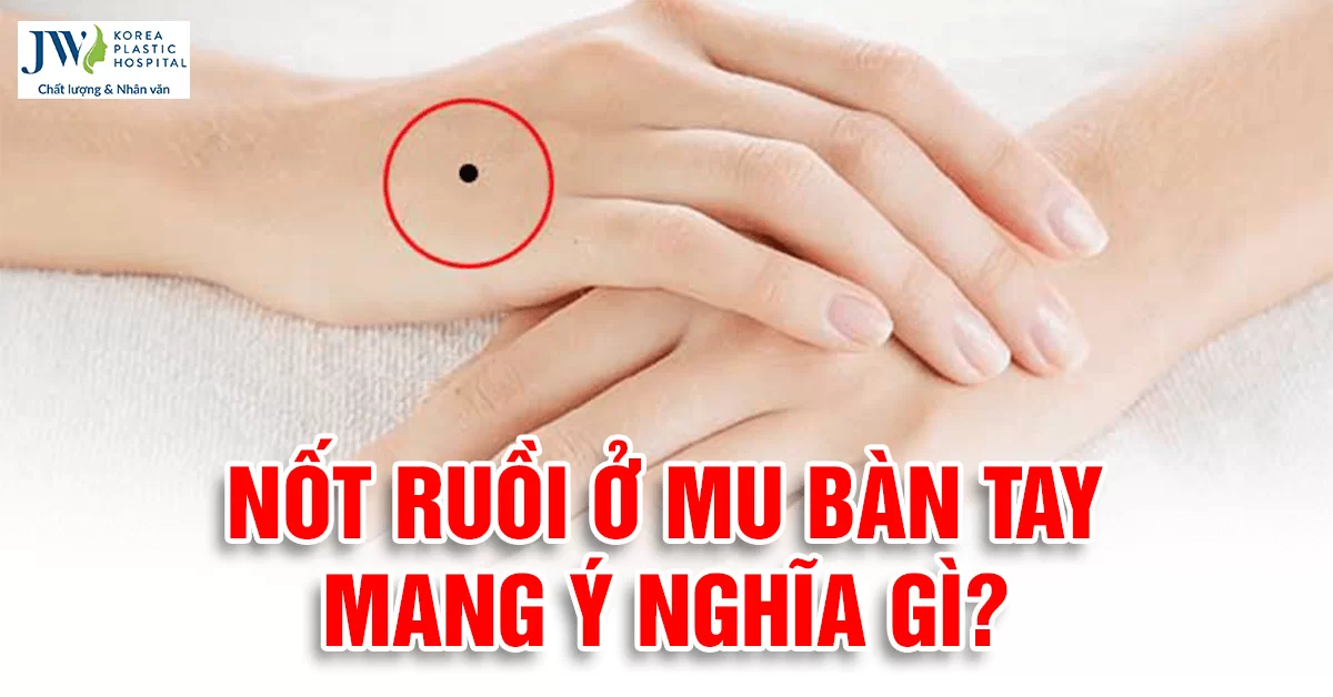 Giải mã tướng số nam, nữ sơ hữu nốt ruồi trên mu bàn tay