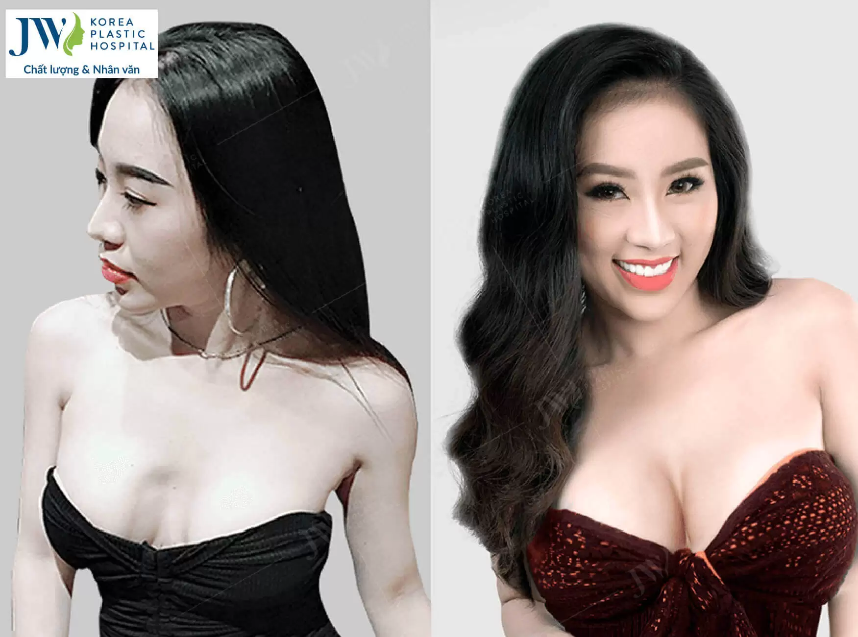 DJ-Nhung-tai-phau-thuat-nguc-tai-jw