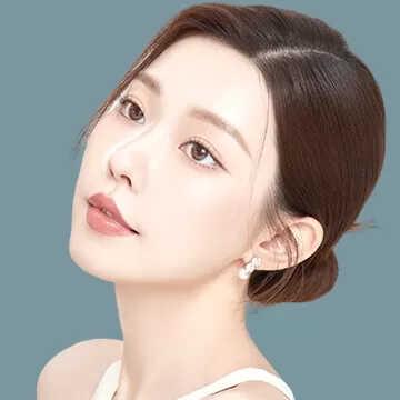 Nâng mũi S Line + Hạ xương bè