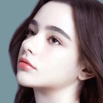 Nâng mũi S Line bọc Megaderm toàn bộ