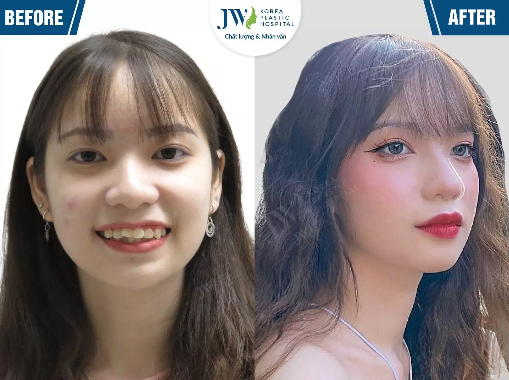 bao ngoc nieng rang jw