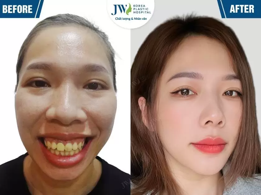 ngoc trinh jw