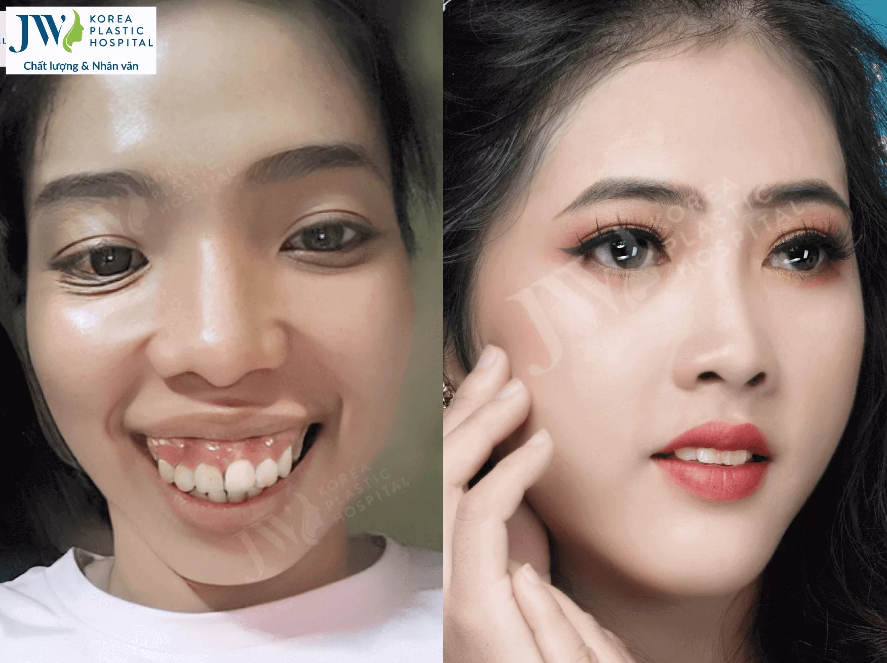 to-quyen-nguoi-dep-tham-my-jw