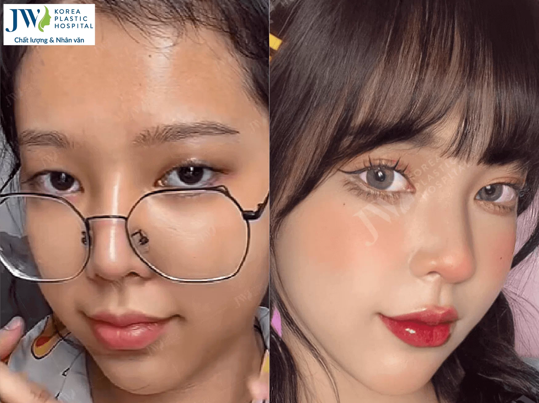 yen-vy-nguoi-dep-tham-my-jw