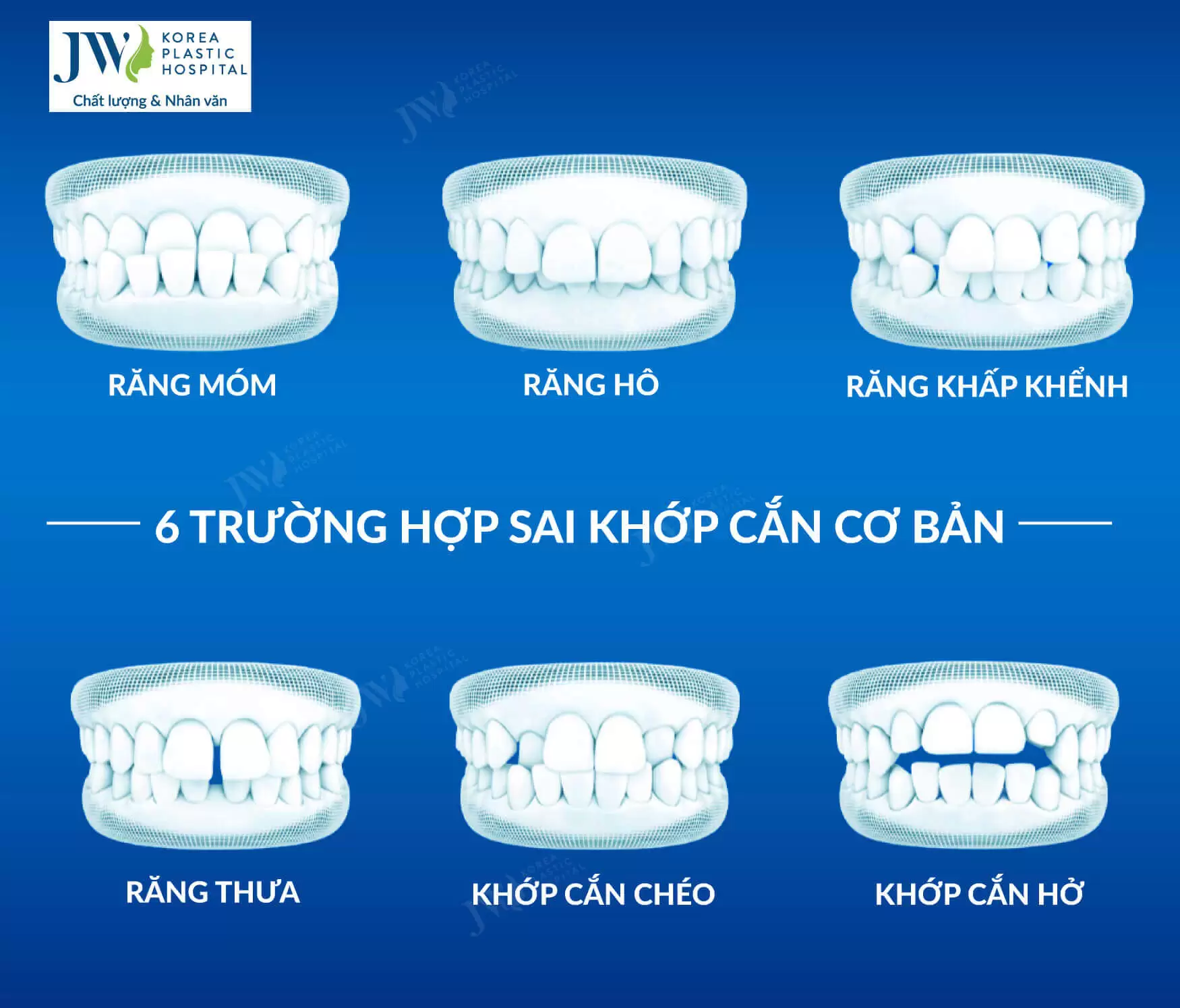 doi-tuong-thuc-hien-nieng-rang-smart