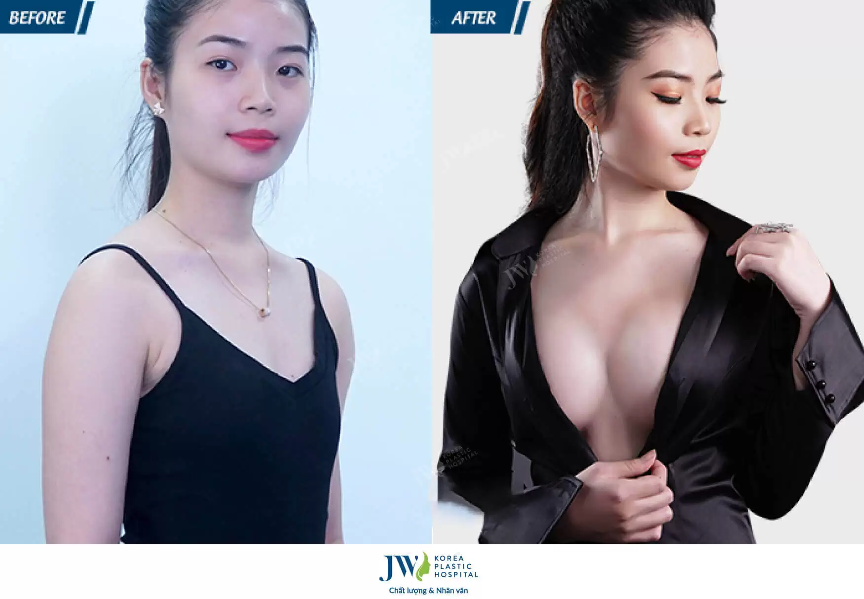 hinh-anh-thuc-te-khach-hang-nang-nguc-tai-jw