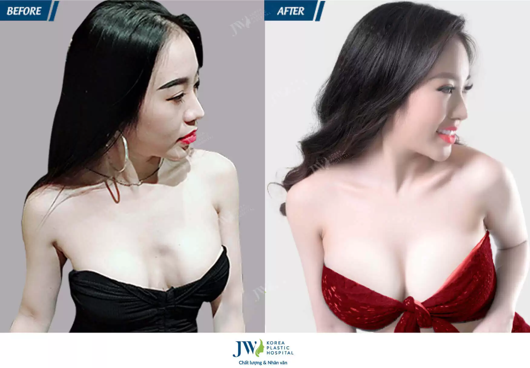 hinh-anh-thuc-te-khach-hang-nang-nguc-tai-j3