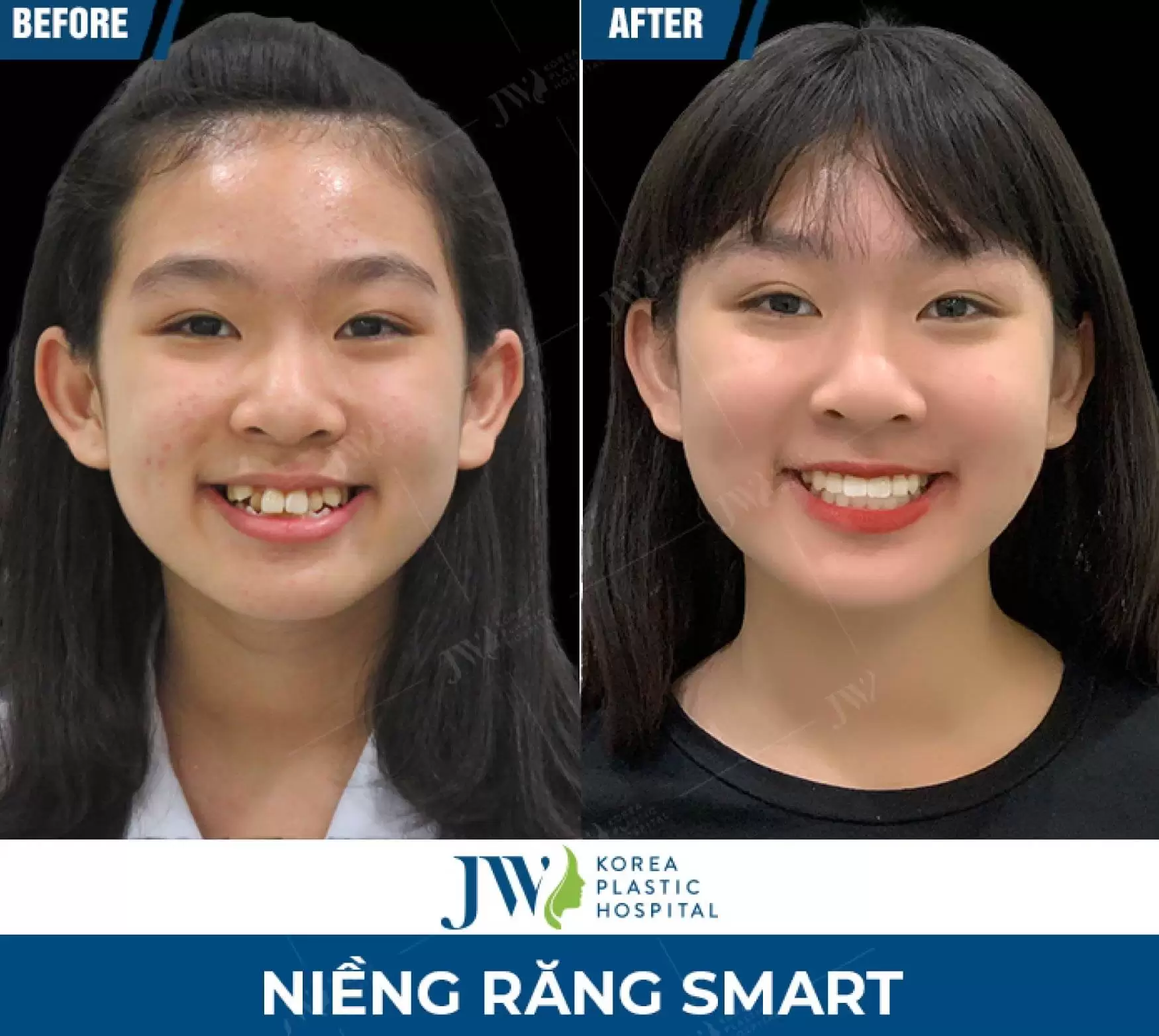 nieng rang dep