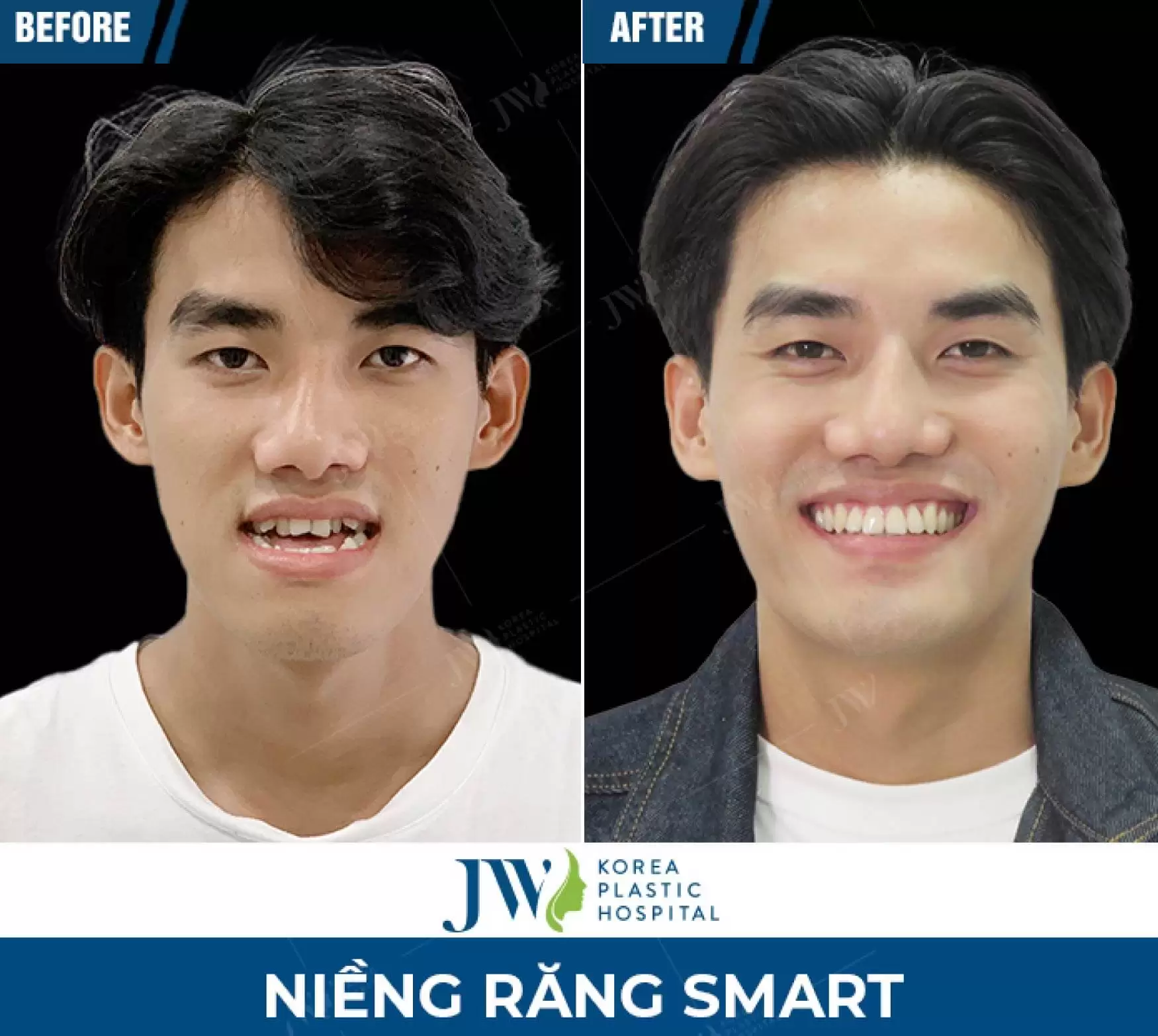 khach-hang-sau-khi-nieng-rang-smart6