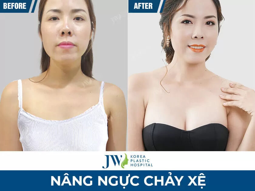 nang-nguc-chay-xe-jw