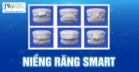 niềng răng SMART