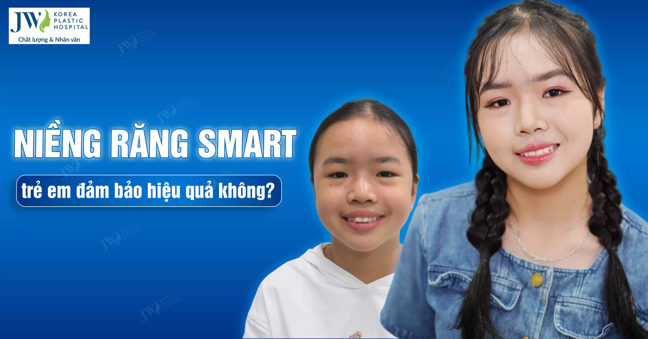 Niềng răng SMART cho trẻ em có đảm bảo hiệu quả không?