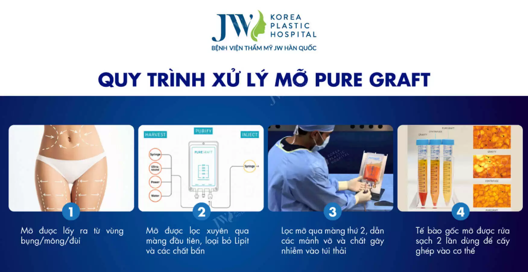 quy-trinh-xu-ly-mo