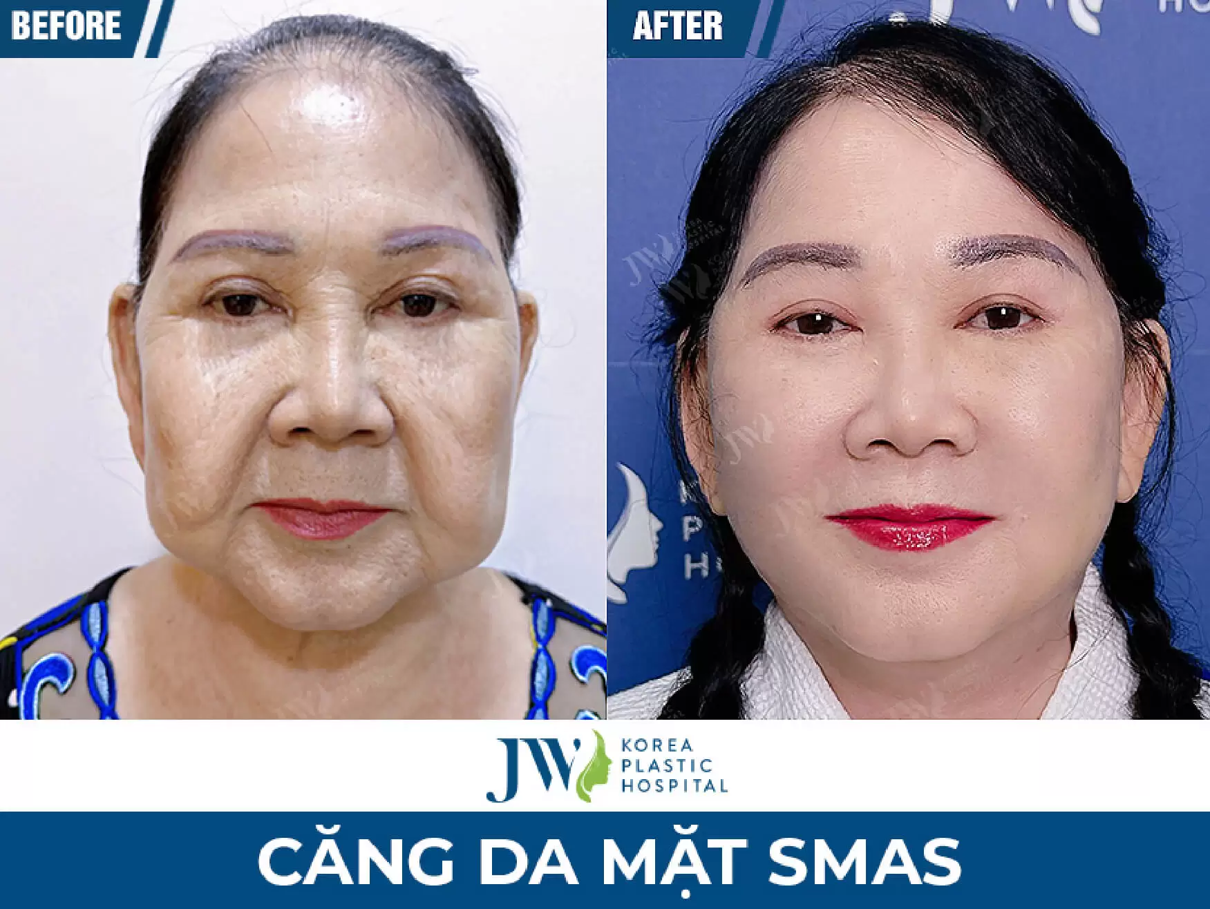 cang da mat tai jw