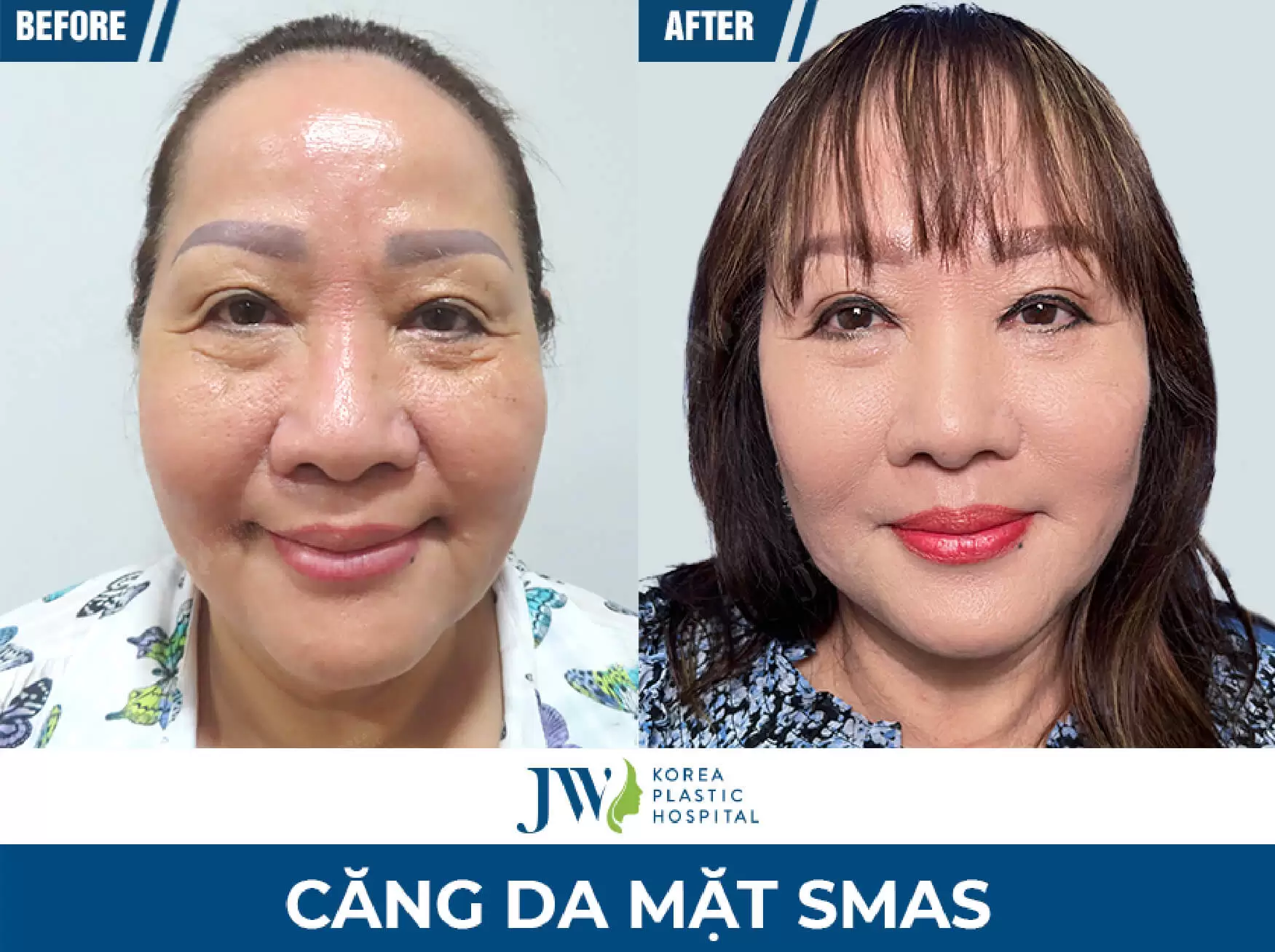 cang da mat dep
