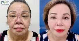 hoat dong kham chua benh