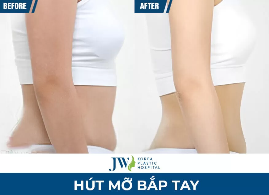 mo bap tay