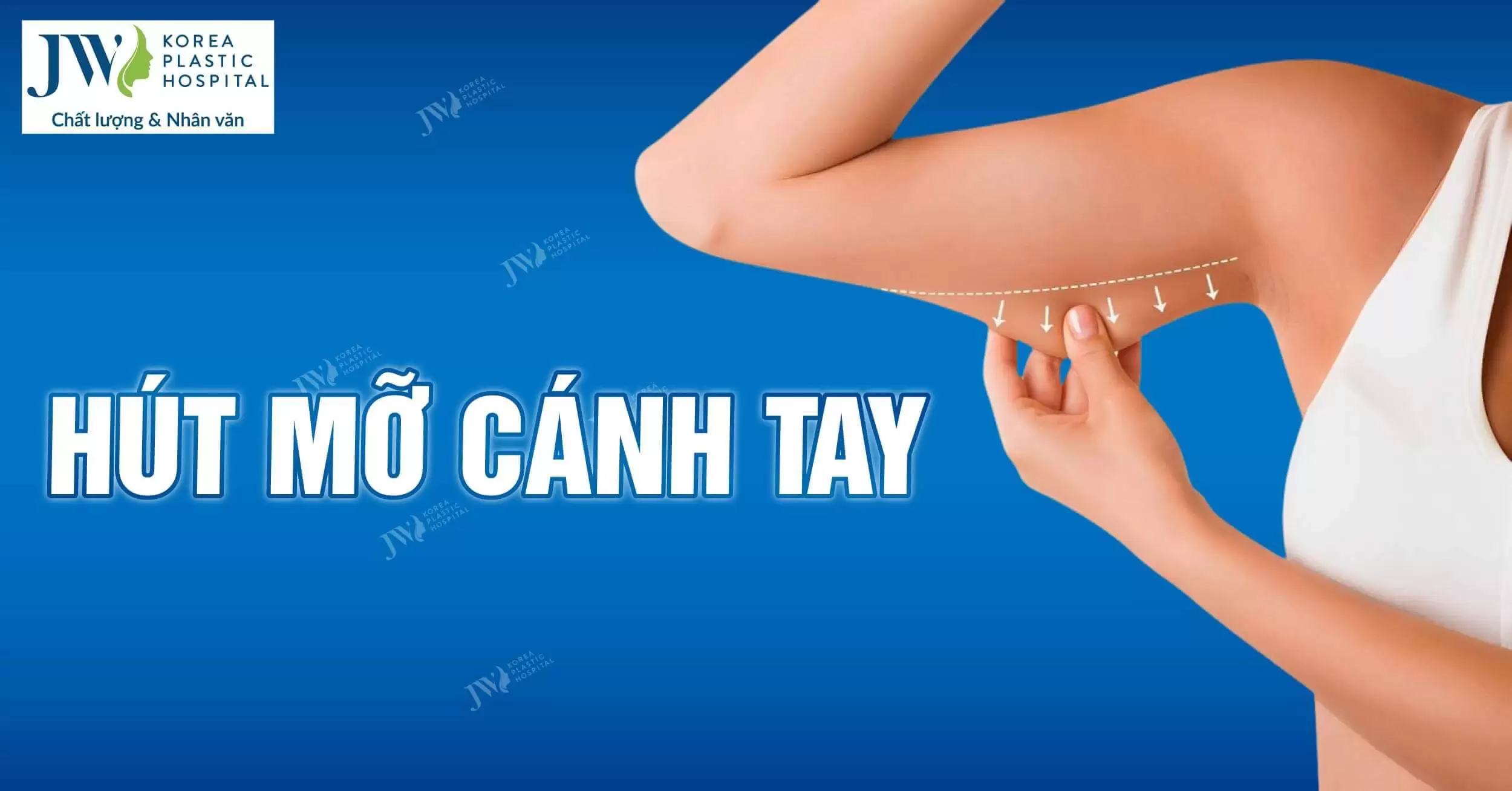 Hút mỡ cánh tay – Hiệu quả lâu dài ở đâu tốt 2024