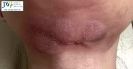 hut mo cam
