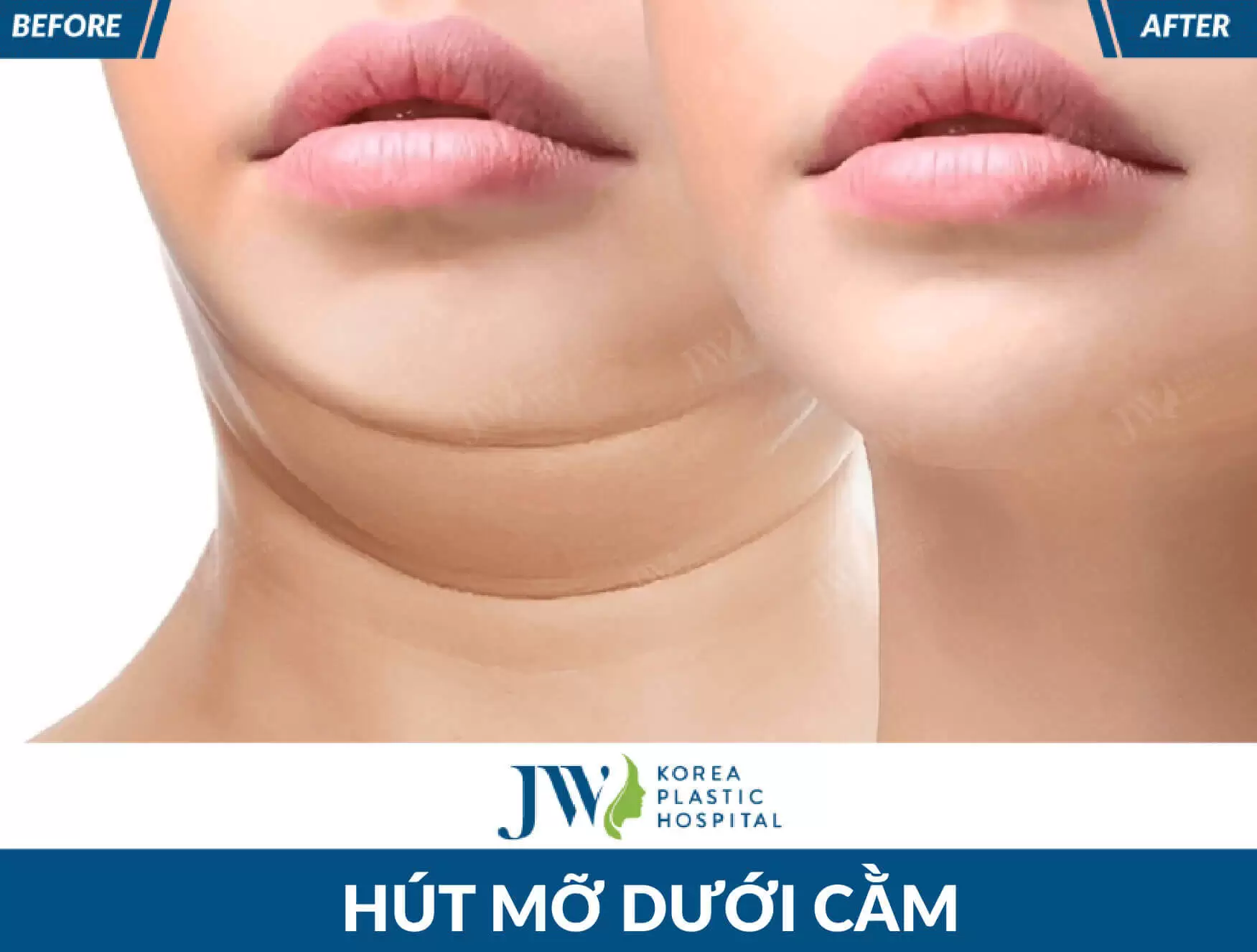 hut mo duoi cam tai jw 