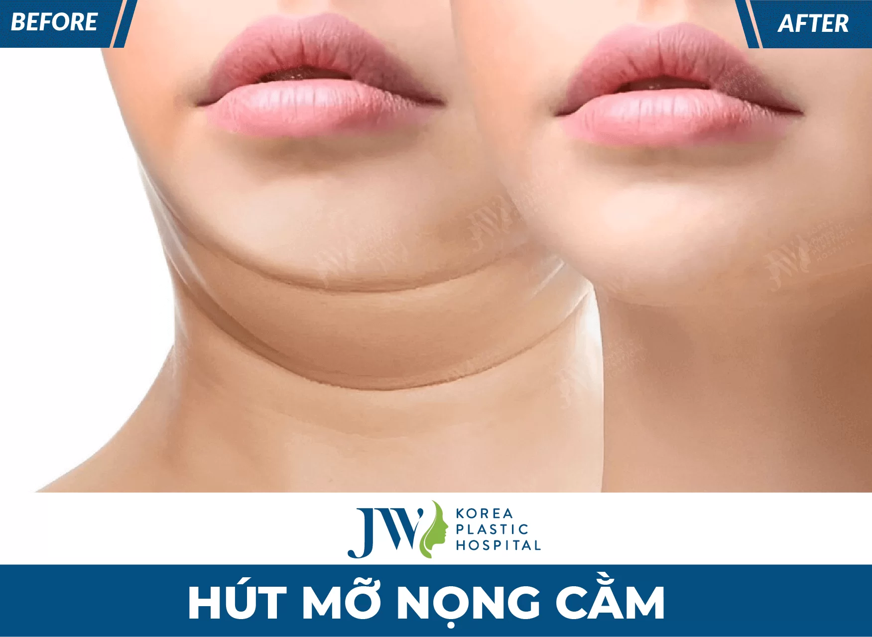 hut mo cam tại jw