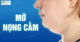 mỡ nọng cằm