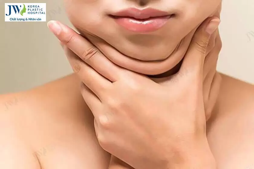 Cách giảm mỡ nọng cằm cho gương mặt thanh tú