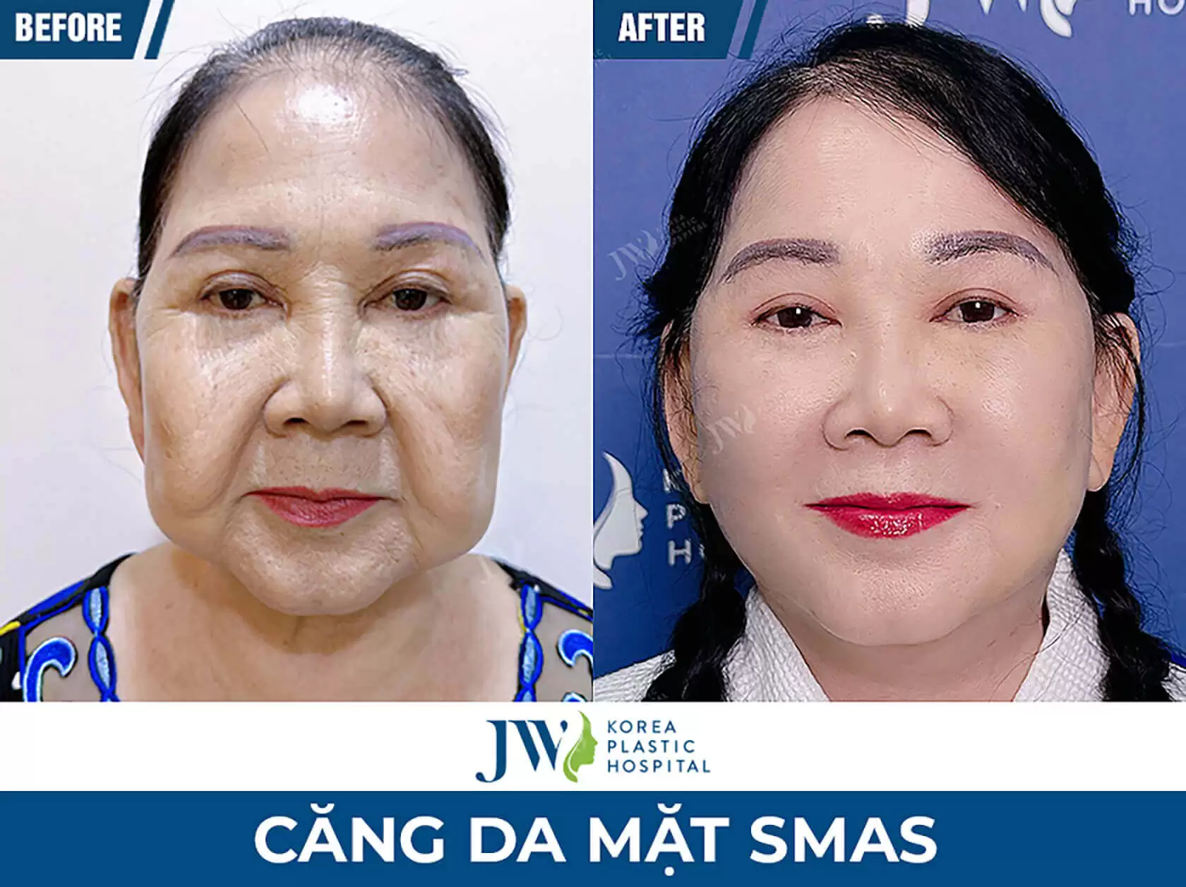 cang da mat 4