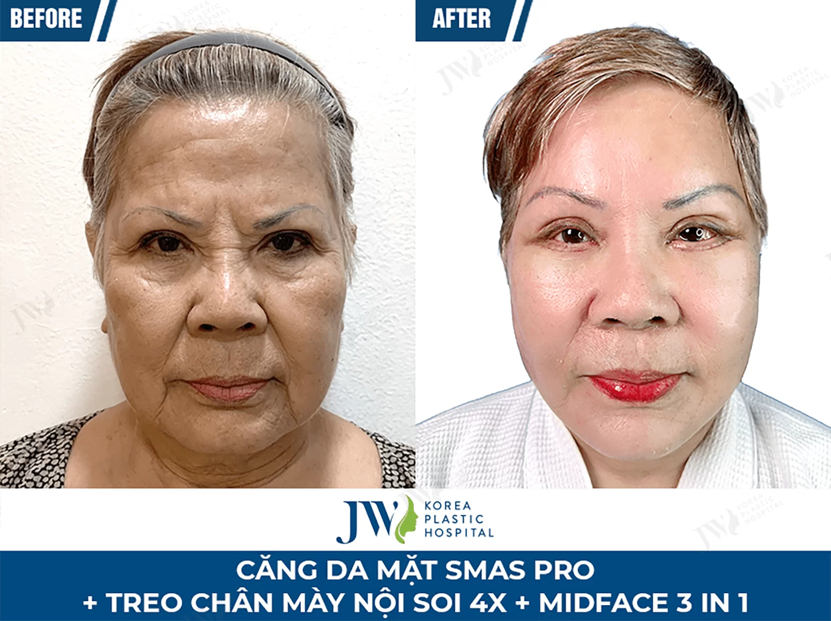 cang da mat 3