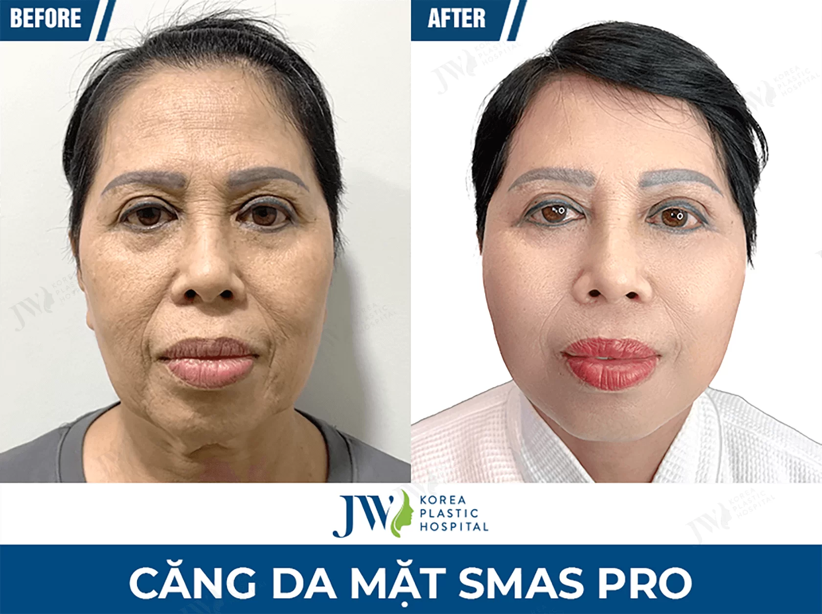 cang da mat 1