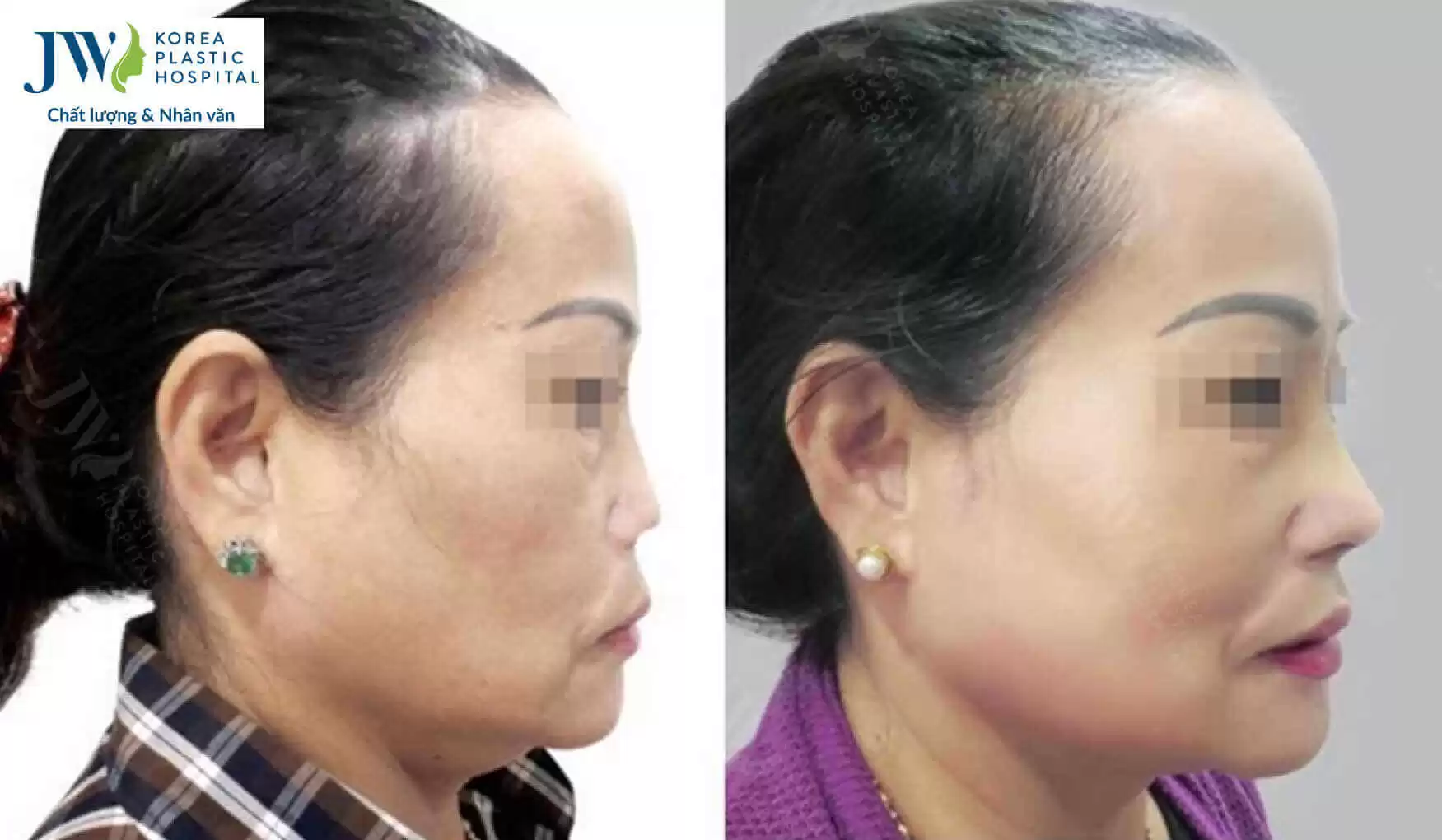 nang mui cho nguoi lon tuoi
