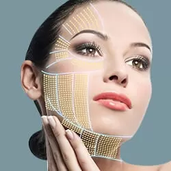 Căng da mặt bán phần + Căng da thái dương 