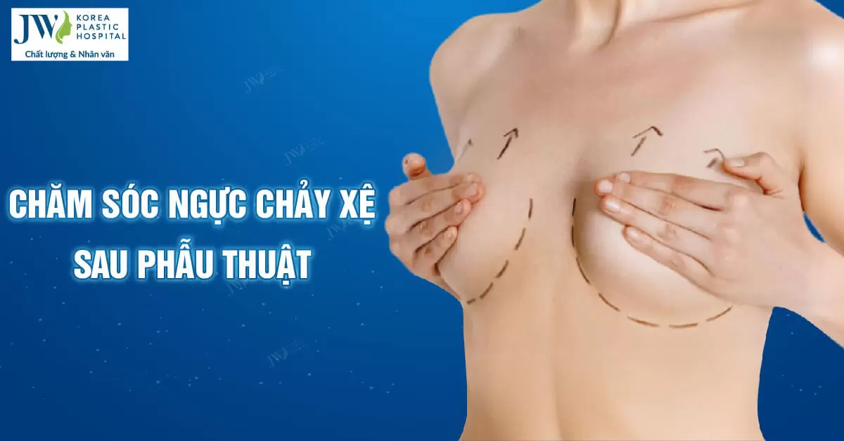 Chăm sóc ngực chảy xệ sau phẫu thuật như thế nào?