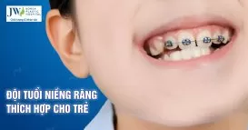 niềng răng cho trẻ
