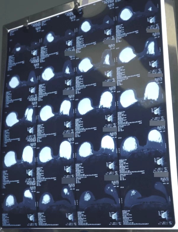 phim-mri-cua-benh-nhan