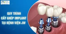 quy trình cấy ghép implant
