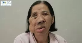 co mang mien tay duoc bac si tu dung cuu chua