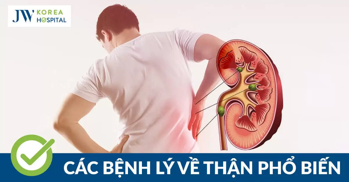 Bệnh lý về thận: Dấu hiệu, nguyên nhân và cách điều trị hiệu quả