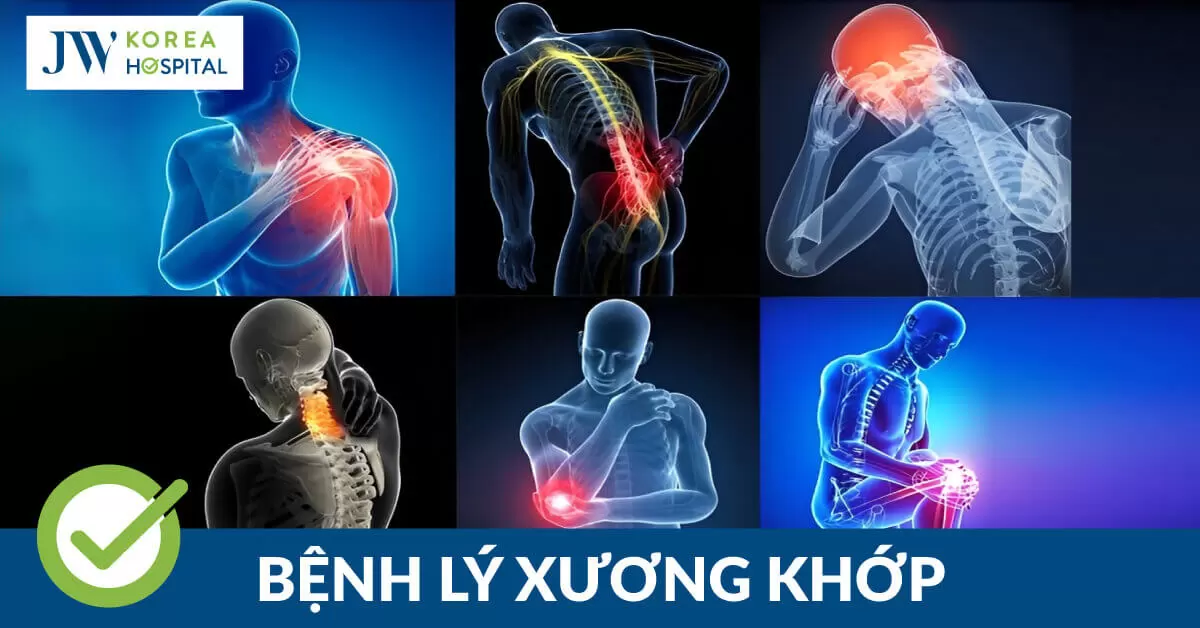 9 căn bệnh xương khớp phổ biến hiện nay đối với mọi lứa tuổi 
