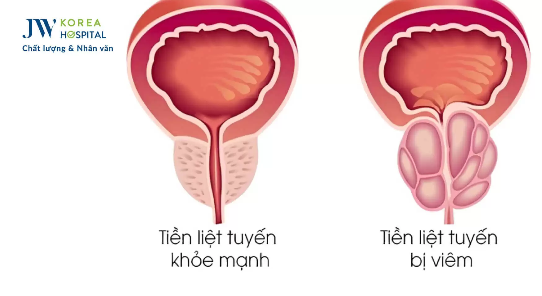 benh-nam-khoa