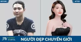 chuyển giới Thoại Vy