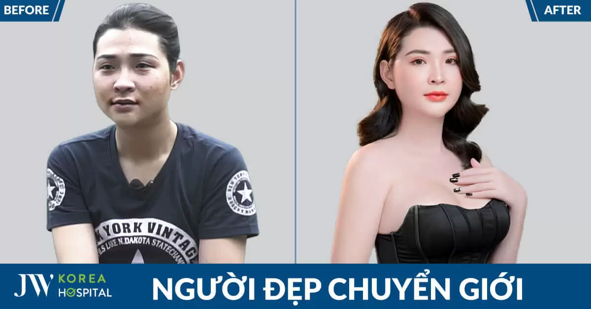 Người đẹp chuyển giới Thoại Vy đánh cược mọi thứ trở thành con gái