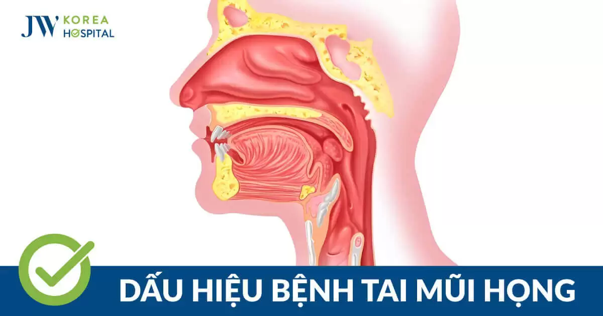 Bệnh tai mũi họng: Nguyên nhân, dấu hiệu và cách nhận biết 