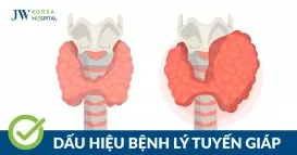 bệnh tuyến giáp