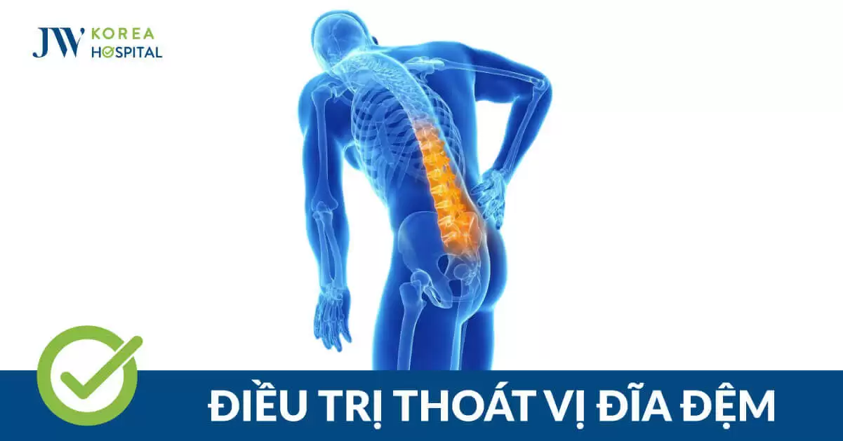 Điều trị thoát vị đĩa đệm hiệu quả tại Bệnh viện JW