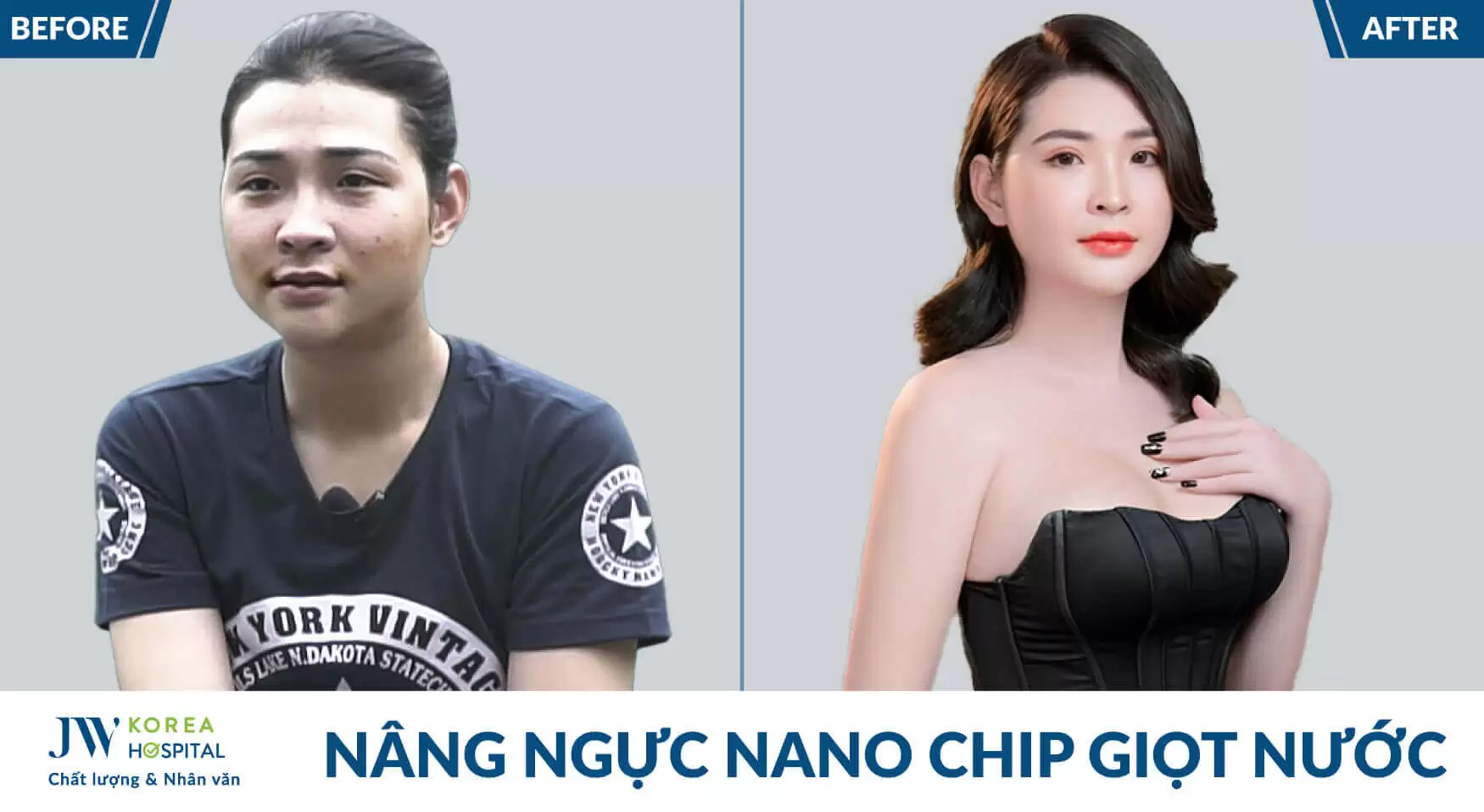nang-nguc-nano-chip