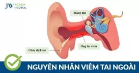 viêm tai