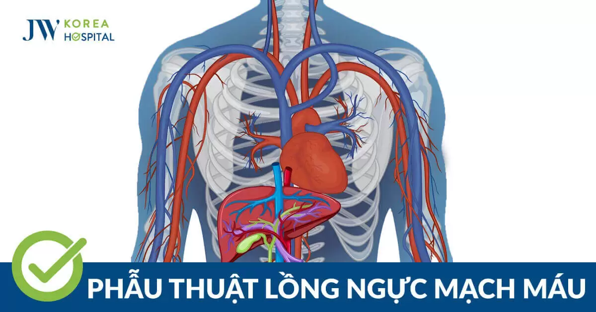 Phẫu thuật lồng ngực mạch máu an toàn tại Bệnh viện JW